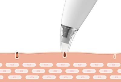 超8.6万人预约，小米有品黑头仪为何成爆款？
